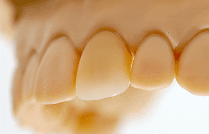 歯のイラスト1